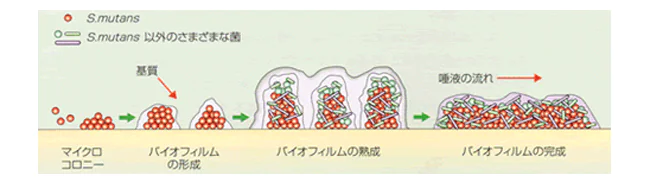 歯ブラシだけでは歯の汚れを落としにくい！？