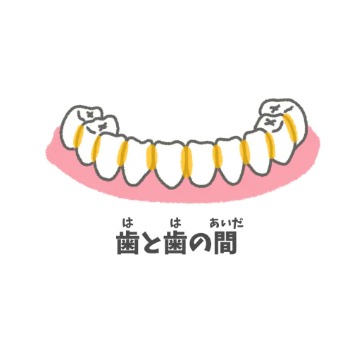 虫歯になりやすい部位｜歯と歯の間